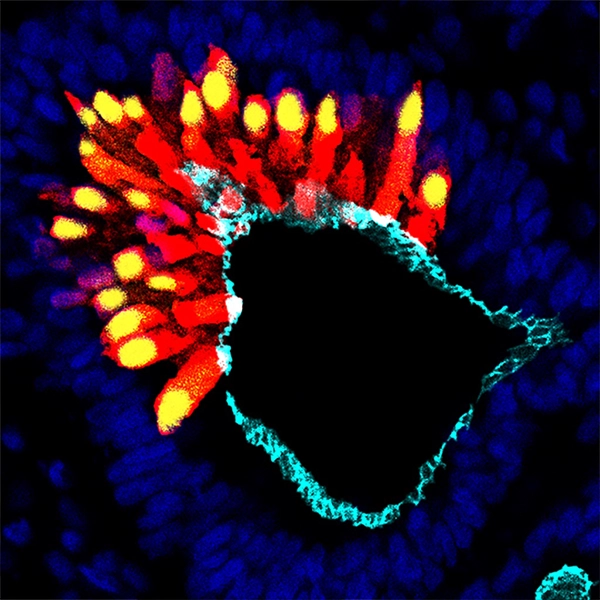 INNER EAR ORGANOID