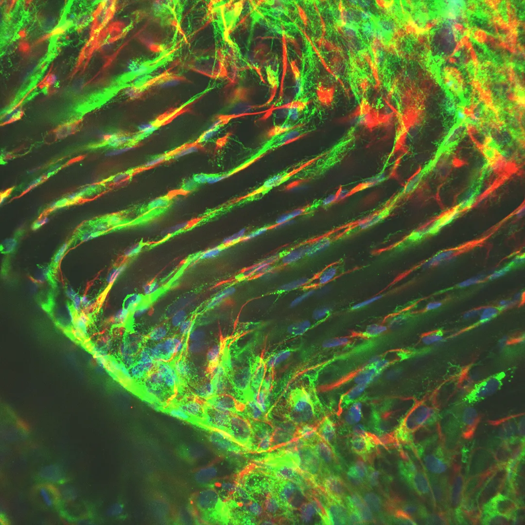 Heart Valve Cells